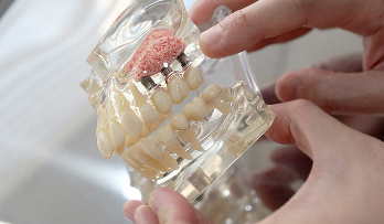 Bone Grafting